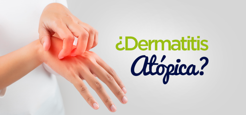 dermatitis atopica