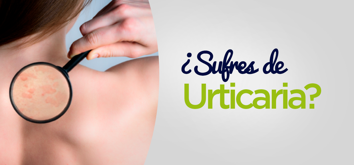Urticaria